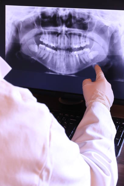 Best Emergency Tooth Extraction in Fayette, MO