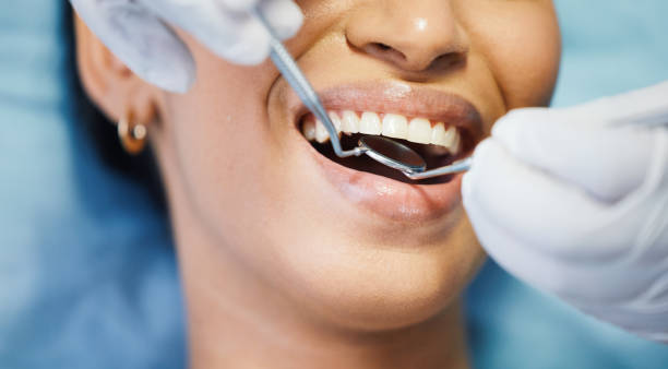 Best Emergency Root Canal Treatment in Fayette, MO