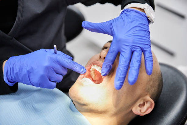 Best Emergency Dental Care for Broken or Chipped Teeth in Fayette, MO